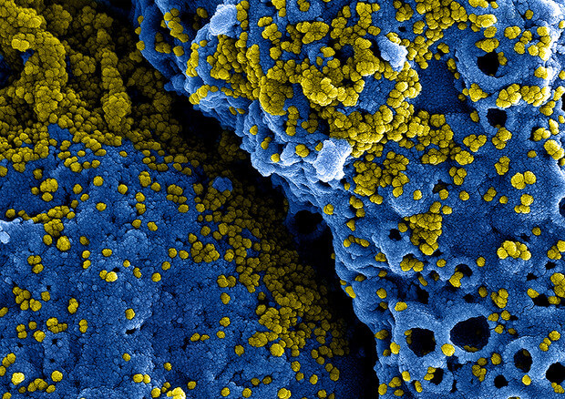 Coronavirus: negli anticorpi un gene cruciale per il vaccino