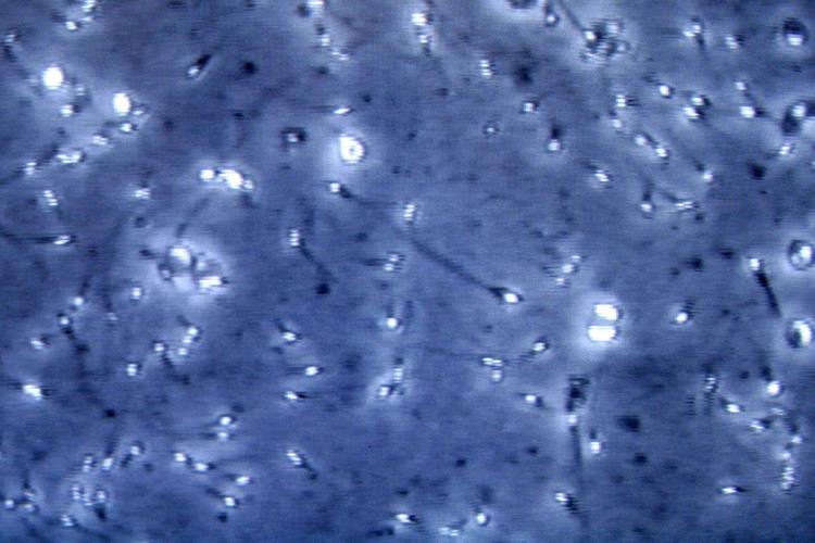 Covid, studio: proteina 'chiave' infezione trovata in spermatozoi